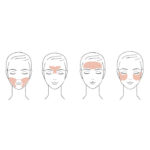 ume-multipack-facial-pads. collagen, anti-wrinkle