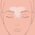 UME frown-lines pads